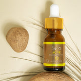 Sona Acne Belly Button Oil for Acne Control - 15 ml